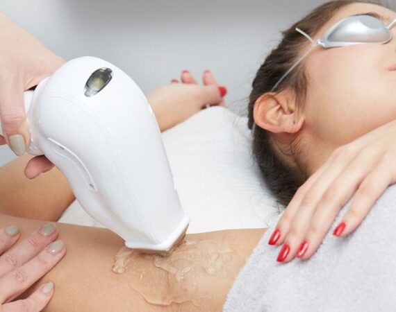 All About Laser Hair Removal